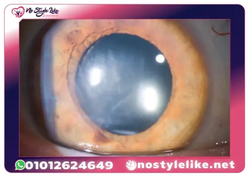 قطره مسكن للعين Muro 128 Drop