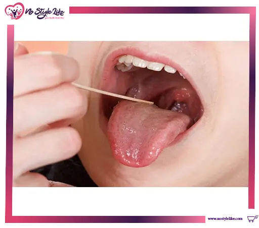 Tyrozets 24 lozenges أقراص الاستحلاب لعلاج التهاب الحلق