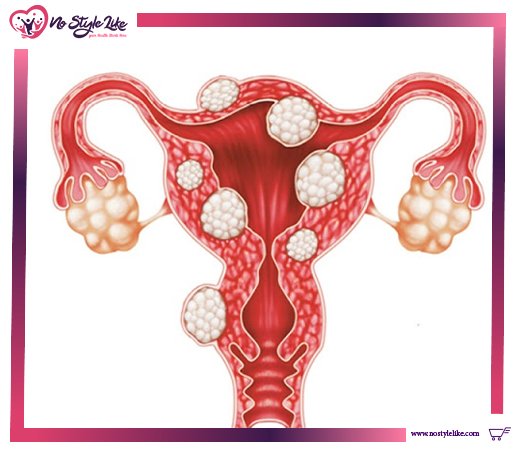 Premarin conjugated Estrogen Vaginal Cream 14g