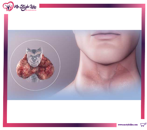Euthyrox 25 Mg 50 tab أقراص يوثيروكس لعلاج قصور الغدة الدرقية