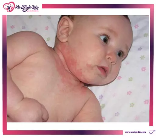 Sudocrem Antiseptic Cream 125 g لعلاج الطفح الجلدى والالتهابات للأطفال