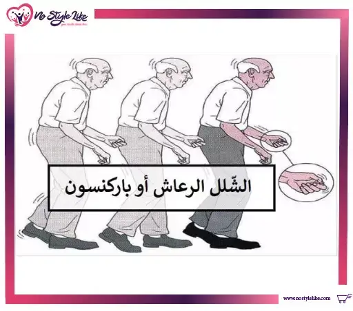أسباب شلل الرعاش