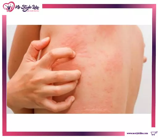 أعراض مرض السيلان وكيفية تشخيصه وعلاجه