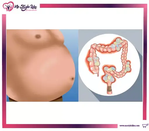 غازات البطن والانتفاخ الأسباب وطرق العلاج