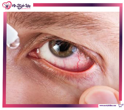 Catalin Eye Drops لعلاج إعتام عدسة العين وضبابية الرؤية