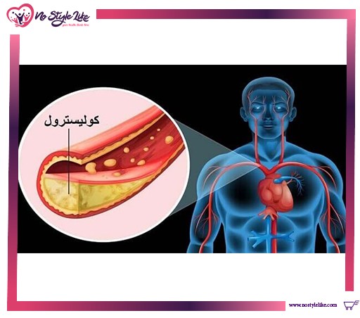 الكوليسترول وتأثيره على القلب