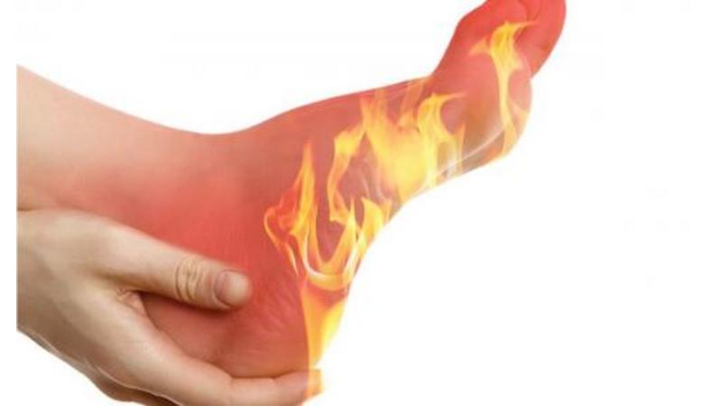 اسباب حرارة القدمين المرتبطة باعتلال الأعصاب