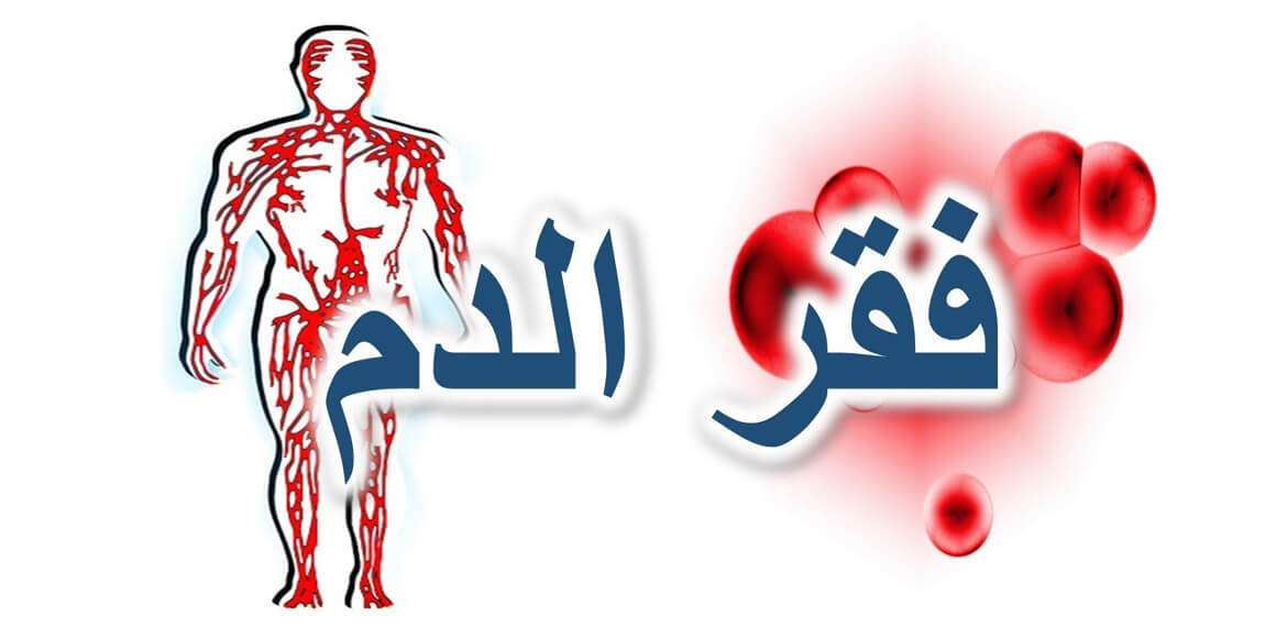 أسباب الأنيميا