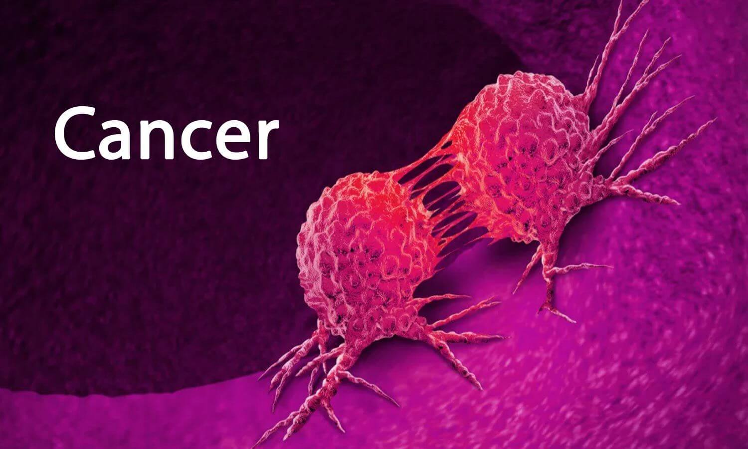 Directed thermal therapy in the treatment of cancerous tumors