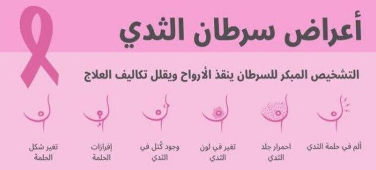سرطان الثدي