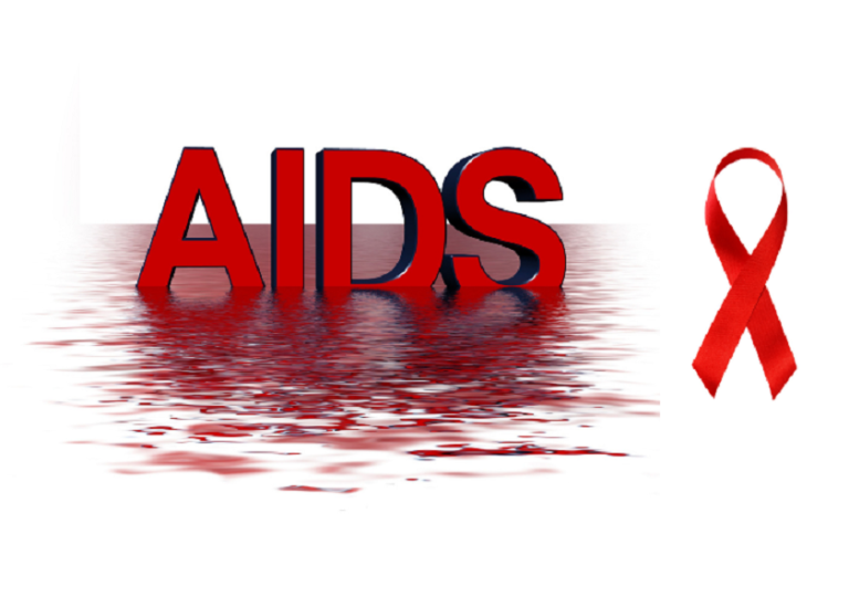 أسباب الإيدز AIDS