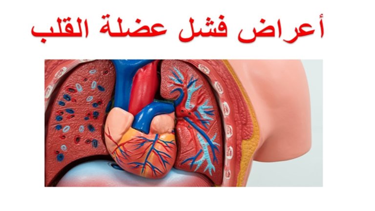 أسباب ضعف عضلة القلب وعلاجها