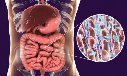 أعراض القولون المتهيج