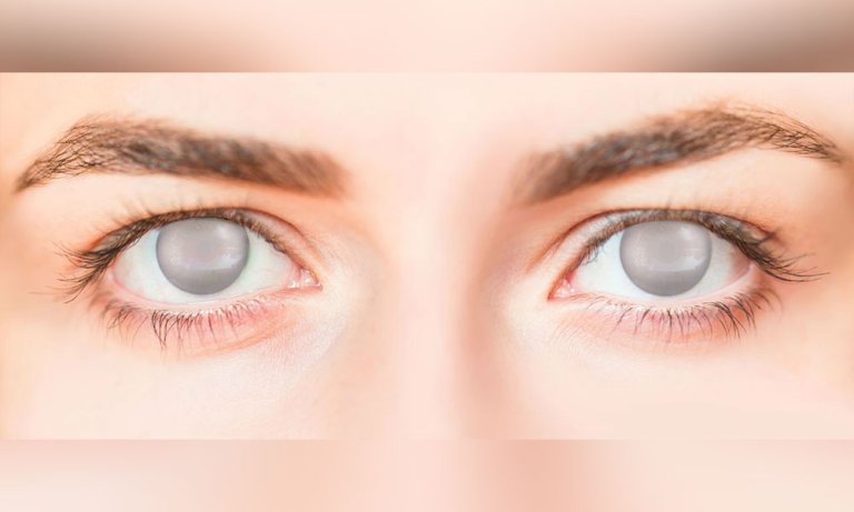 أسباب العمى Blind