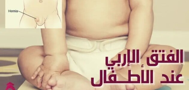الفتق الأربي عند الأطفال
