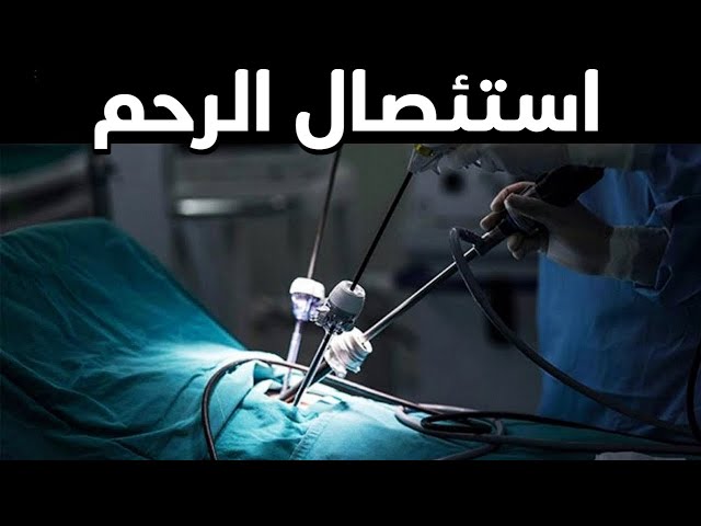 إستئصال الرحم