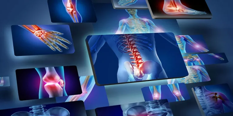 مضادات الالتهاب الطبيعية
