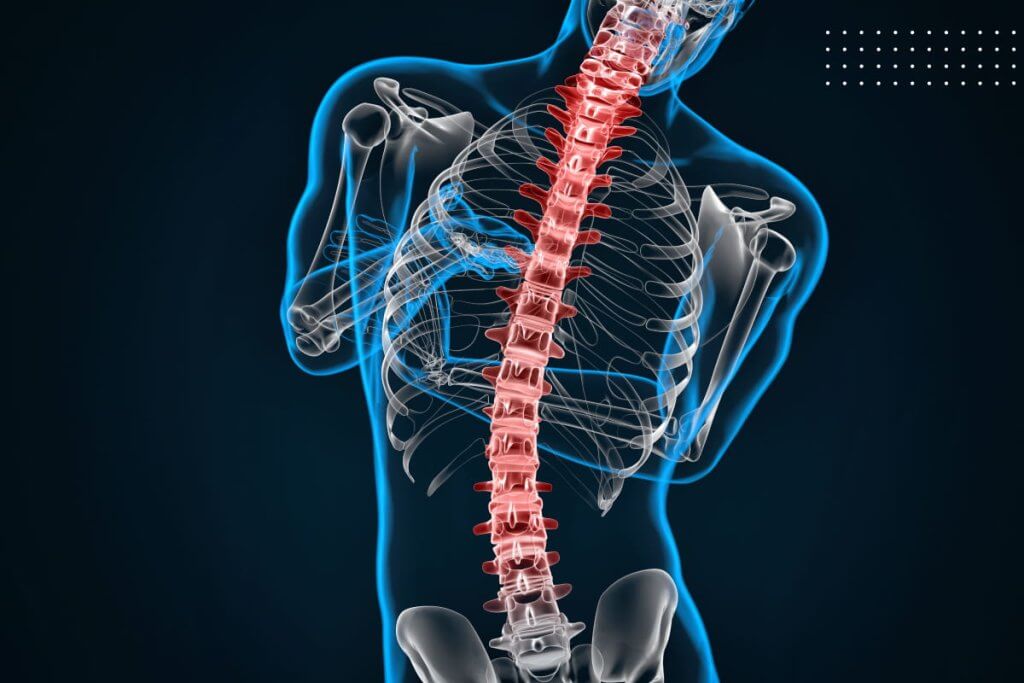 ضمور العضلات (Muscular Dystrophy)