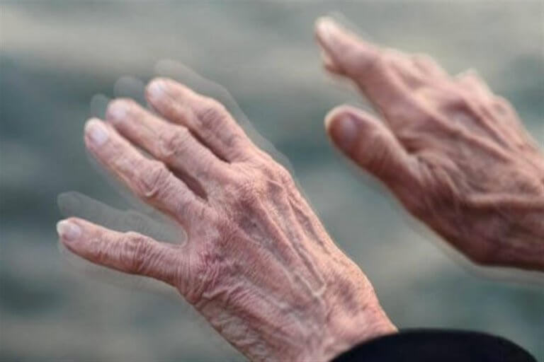 أسباب شلل الرعاش