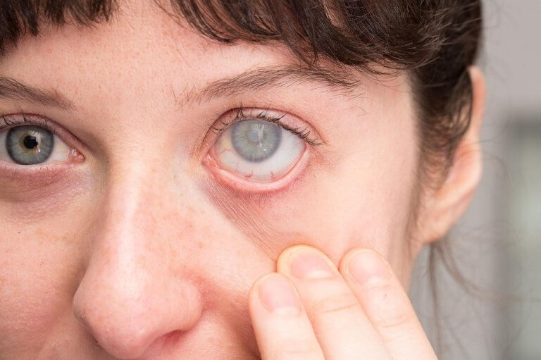 أعراض الساد تظهر كضبابية في الرؤية