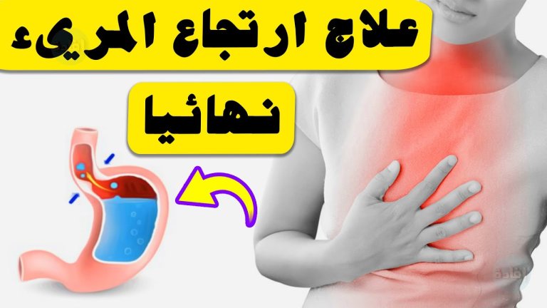 علاج ارتجاع المريء بطرق طبيعية
