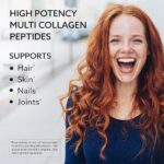 Amplicell COLLAGEN PEPTIDES HYDROLYZED TYPE I & III COLLAGEN دعم متكامل للبشرة، الشعر، المفاصل والعظام