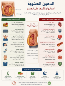 أسباب الدهون الحشوية وتأثيرها على الجسم